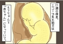 外見は新生児に近づく(妊娠6ヵ月/妊娠中期) 外見は新生児に近づく(妊娠6ヵ月/妊娠中期)