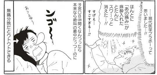 無痛分娩 無痛分娩